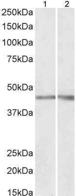 Western blot - Anti-NPHS2 antibody (AB177242)