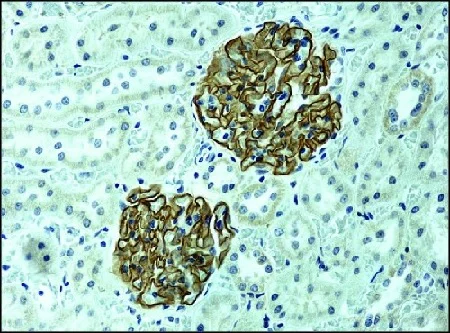 Immunohistochemistry (Formalin/PFA-fixed paraffin-embedded sections) - Anti-NPHS2 antibody (AB50339)