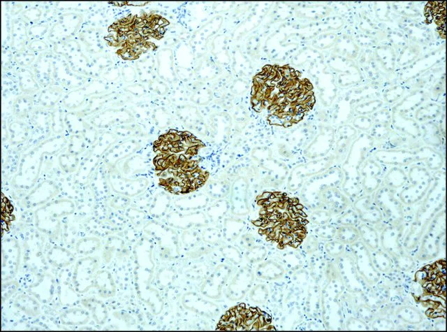 【puniさま専用】Eaphi ASYMMETRY DETAIL COAT Chapter 01