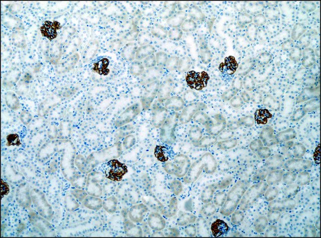 Immunohistochemistry (Formalin/PFA-fixed paraffin-embedded sections) - Anti-NPHS2 antibody (AB50339)