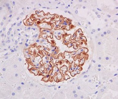 Immunohistochemistry (Formalin/PFA-fixed paraffin-embedded sections) - Anti-NPHS2 antibody [EPR13819] (AB183703), expandable thumbnail