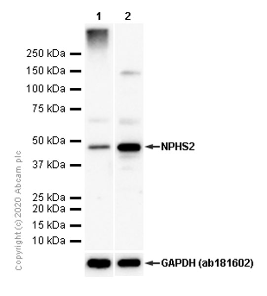Western blot - Anti-NPHS2 antibody [EPR13819] (AB183703), expandable thumbnail