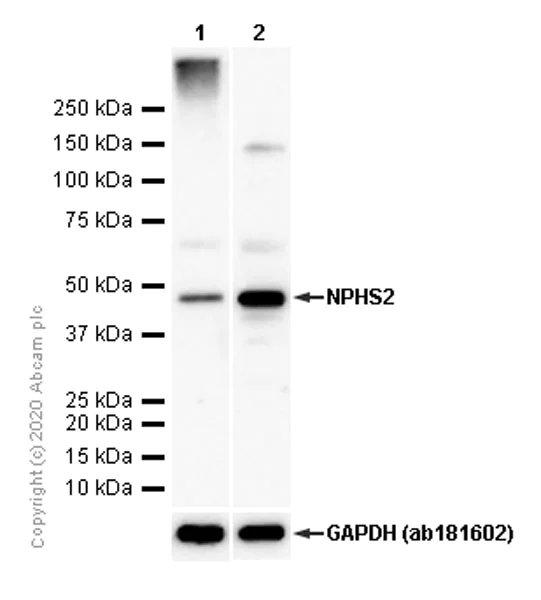 Western blot - Anti-NPHS2 antibody [EPR13819] (AB183703)