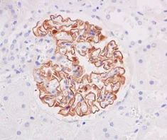 Immunohistochemistry (Formalin/PFA-fixed paraffin-embedded sections) - Anti-NPHS2 antibody [EPR13819] - BSA and Azide free (AB250681)