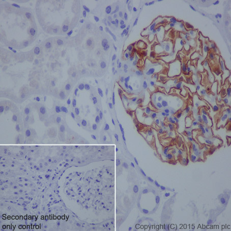 Immunohistochemistry (Formalin/PFA-fixed paraffin-embedded sections) - Anti-NPHS2 antibody [EPR13820] (AB181143), expandable thumbnail
