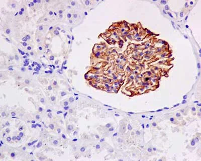 Immunohistochemistry (Formalin/PFA-fixed paraffin-embedded sections) - Anti-NPHS2 antibody [EPR13820] (AB181143)