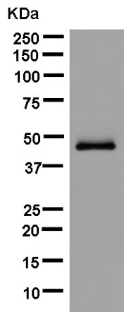 Western blot - Anti-NPHS2 antibody [EPR13820] (AB181143), expandable thumbnail