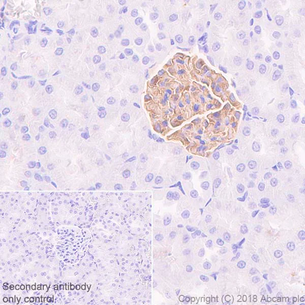 Immunohistochemistry (Formalin/PFA-fixed paraffin-embedded sections) - Anti-NPHS2 antibody [EPR22203-219] (AB229037)