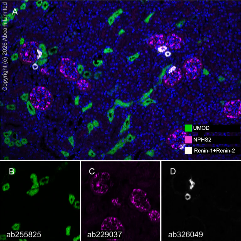 Multiplex immunohistochemistry - Anti-NPHS2 antibody [EPR22203-219] - BSA and Azide free (AB239758)