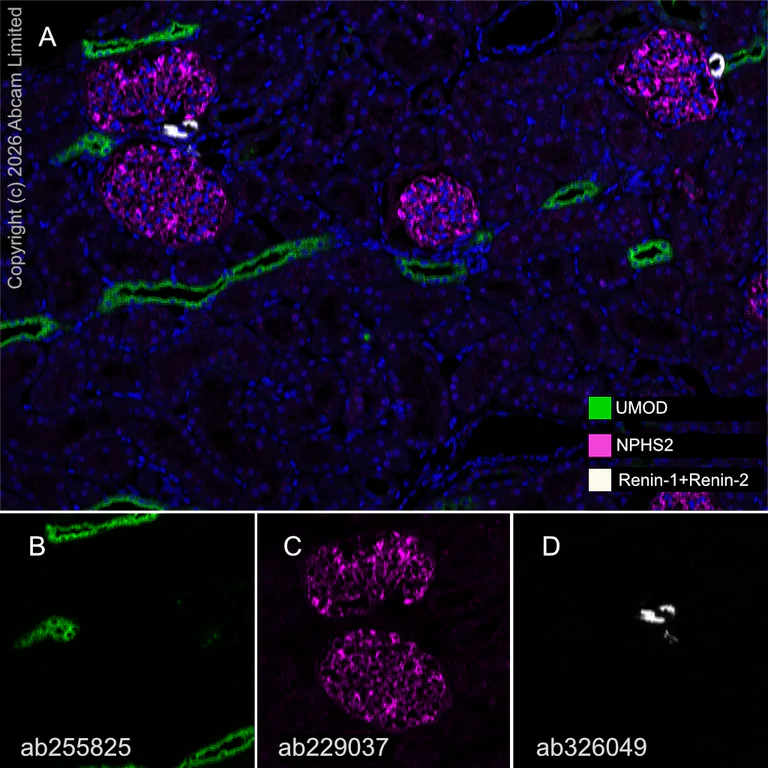 Multiplex immunohistochemistry - Anti-NPHS2 antibody [EPR22203-219] - BSA and Azide free (AB239758)