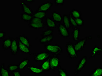 Immunocytochemistry/ Immunofluorescence - Anti-NPL antibody (AB223521)