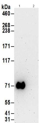 Immunoprecipitation - Anti-NPL4 antibody (AB176383)