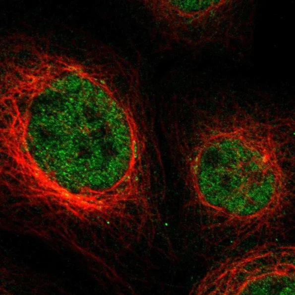 Immunocytochemistry/ Immunofluorescence - Anti-NPL4 antibody (AB224435)