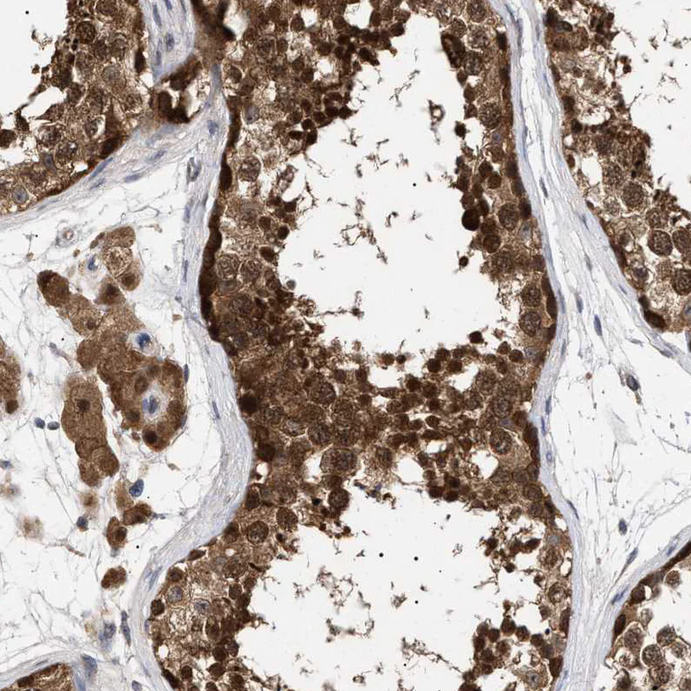 Immunohistochemistry (Formalin/PFA-fixed paraffin-embedded sections) - Anti-NPL4 antibody (AB224435)