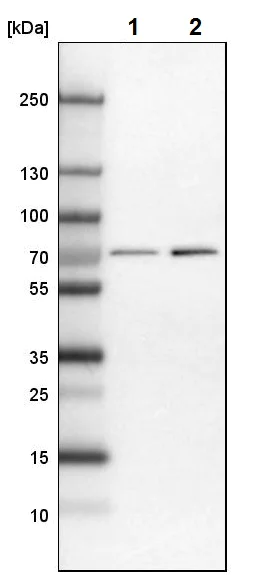 Western blot - Anti-NPL4 antibody (AB224435)