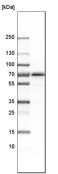 Western blot - Anti-NPL4 antibody (AB224435)