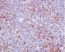 Immunohistochemistry (Formalin/PFA-fixed paraffin-embedded sections) - Anti-NPM1/ALK antibody [EPR11413] (AB180607)
