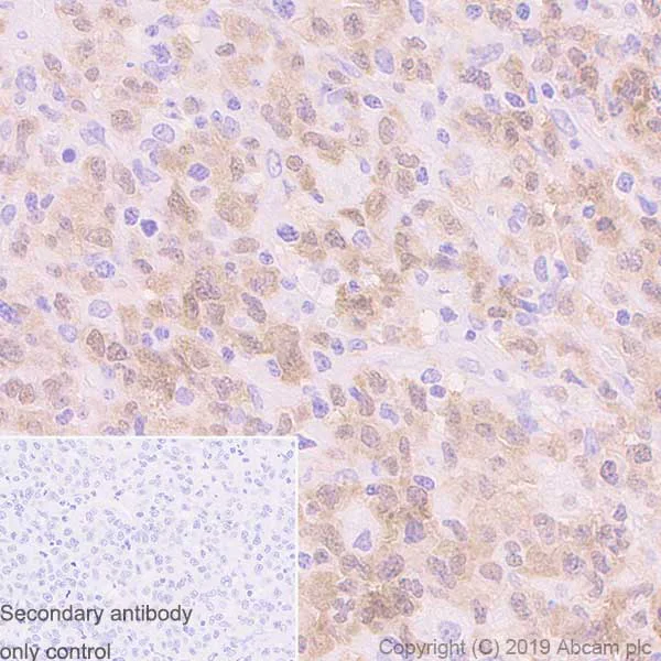 Immunohistochemistry (Formalin/PFA-fixed paraffin-embedded sections) - Anti-NPM1/ALK antibody [EPR11413] (AB180607)