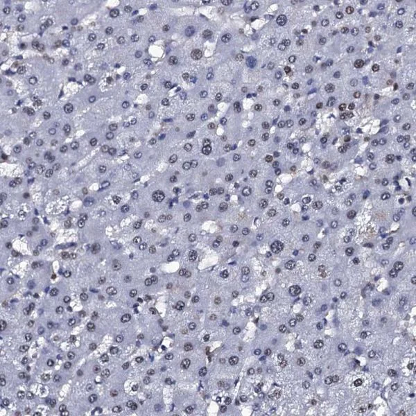 Immunohistochemistry (Formalin/PFA-fixed paraffin-embedded sections) - Anti-NPM2 antibody (AB243544)