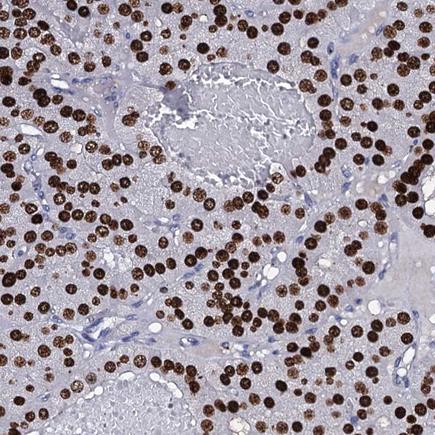 Immunohistochemistry (Formalin/PFA-fixed paraffin-embedded sections) - Anti-NPM2 antibody (AB243544)