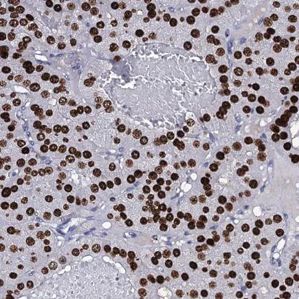 Immunohistochemistry (Formalin/PFA-fixed paraffin-embedded sections) - Anti-NPM2 antibody (AB243544)