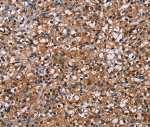 Immunohistochemistry (Formalin/PFA-fixed paraffin-embedded sections) - Anti-NPM3 antibody (AB198224)