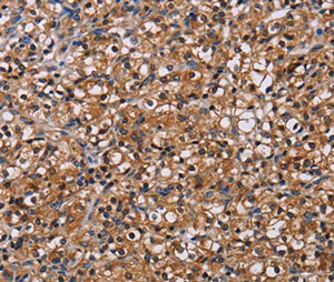 Immunohistochemistry (Formalin/PFA-fixed paraffin-embedded sections) - Anti-NPM3 antibody (AB198224)