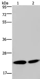 Western blot - Anti-NPM3 antibody (AB198224)