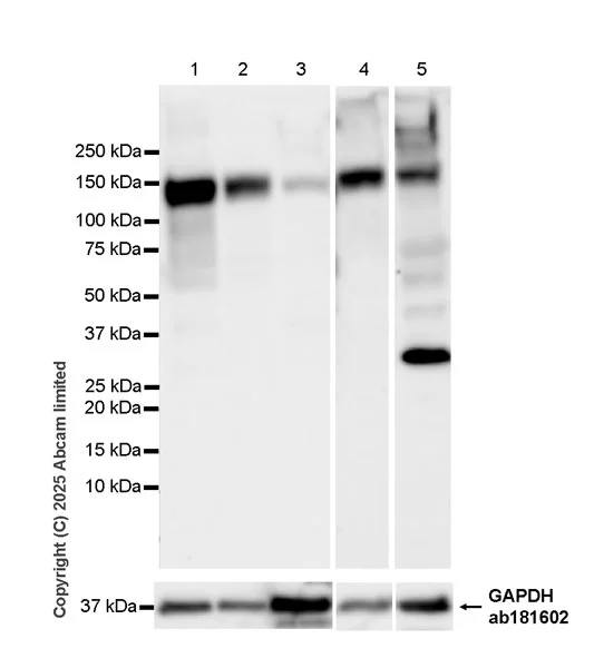 Western blot - Anti-NPR-A/Atrial natriuretic peptide receptor 1 antibody [EPR30453-586] (AB325540)