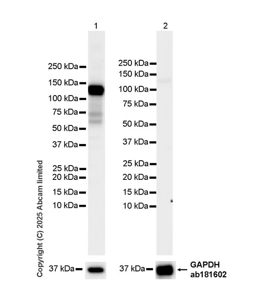 Western blot - Anti-NPR-A/Atrial natriuretic peptide receptor 1 antibody [EPR30453-586] (AB325540)