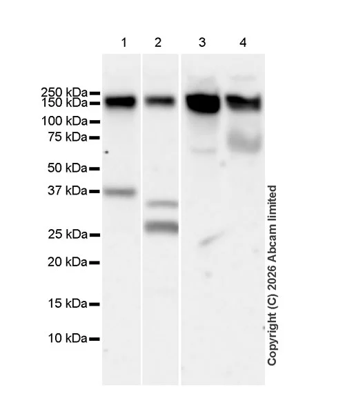 Western blot - Anti-NPR-A/Atrial natriuretic peptide receptor 1 antibody [EPR30453-586] (AB325540)