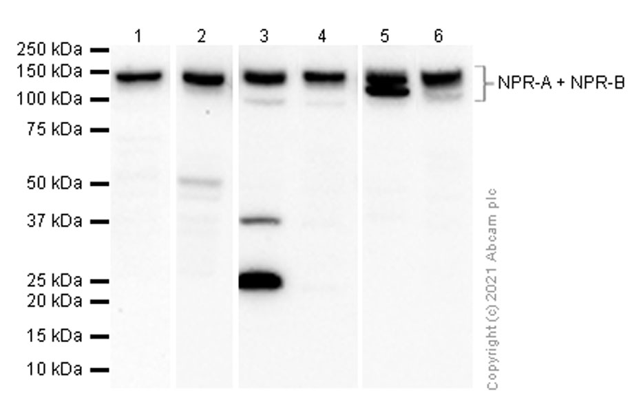 Western blot - Anti-NPR-A + NPR-B antibody [EPR5719(2)] (AB139188)