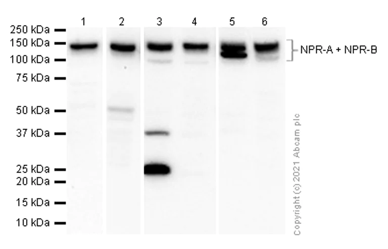 Western blot - Anti-NPR-A + NPR-B antibody [EPR5719(2)] (AB139188)