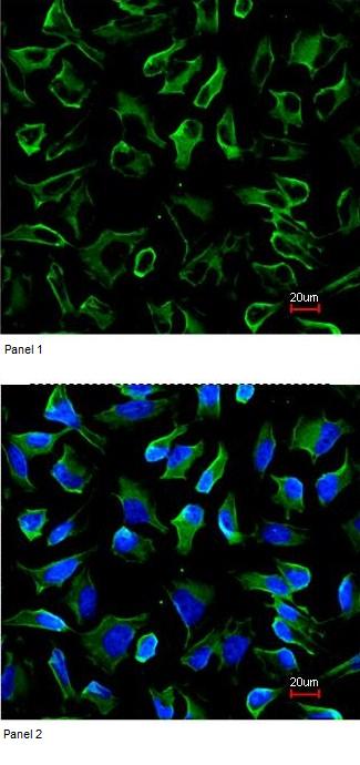Immunocytochemistry/ Immunofluorescence - Anti-NPR-C antibody (AB97389), expandable thumbnail