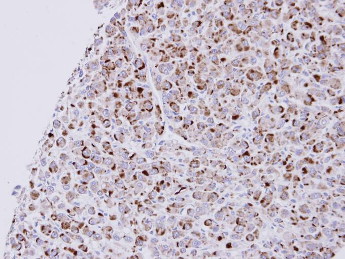 Immunohistochemistry (Formalin/PFA-fixed paraffin-embedded sections) - Anti-NPR-C antibody (AB97389), expandable thumbnail
