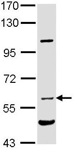 Western blot - Anti-NPR-C antibody (AB97389), expandable thumbnail