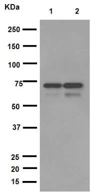 Western blot - Anti-NPR-C antibody [EPR12716] - C-terminal (AB177954)