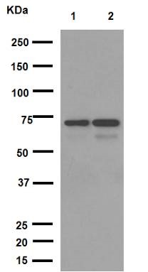 Western blot - Anti-NPR-C antibody [EPR12716] - C-terminal (AB177954)