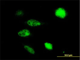 Immunocytochemistry/ Immunofluorescence - Anti-NPRL2 antibody (AB88691)