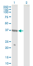 Western blot - Anti-NPRL2 antibody (AB88691), expandable thumbnail