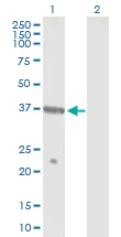 Western blot - Anti-NPRL2 antibody (AB88691)