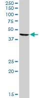 Western blot - Anti-NPRL2 antibody (AB88691)