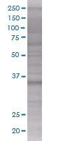 SDS-PAGE - NPRL2 overexpression 293T lysate (whole cell) (AB94324)