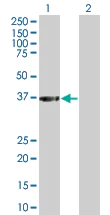 Western blot - NPRL2 overexpression 293T lysate (whole cell) (AB94324)