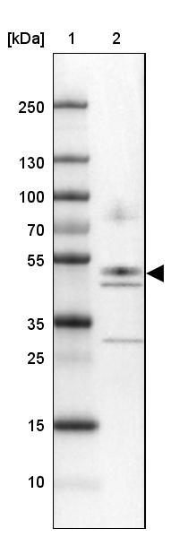 Western blot - Anti-NPTN antibody (AB272652)