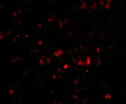 Immunocytochemistry/ Immunofluorescence - Anti-NPTX2 antibody (AB69858)