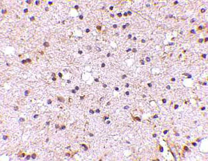 Immunohistochemistry (Formalin/PFA-fixed paraffin-embedded sections) - Anti-NPTX2 antibody (AB69858)