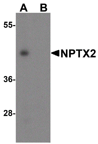 Western blot - Anti-NPTX2 antibody (AB69858)