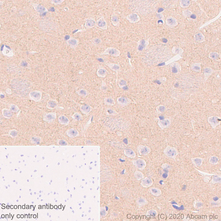 Immunohistochemistry (Formalin/PFA-fixed paraffin-embedded sections) - Anti-NPTX2 antibody [EPR24020-38] (AB277523)