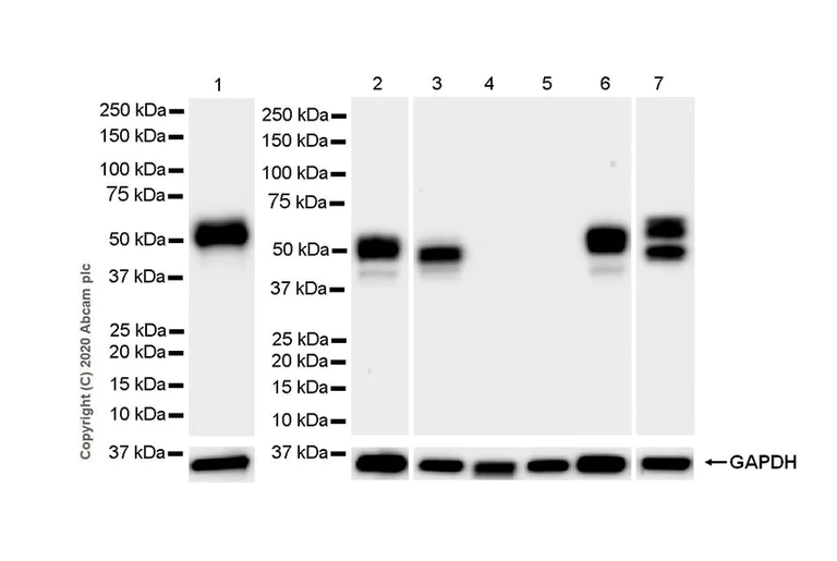 Western blot - Anti-NPTX2 antibody [EPR24020-38] (AB277523)